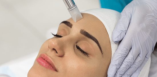 Microneedling face